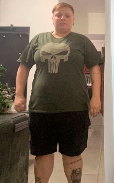 Antes do acompanhamento de Gerage - 10 meses de acompanhamento - 30kg a menos; redução do volume de mamas e quadril; sem uso de T